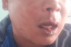 Không chịu xuất trình vé, hành khách tấn công kiểm soát viên xe buýt