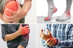 Thuốc giảm đau, viêm xương khớp: Cần đề phòng các bất lợi khi dùng