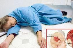 Những lưu ý khi sơ cứu người bệnh đột quỵ an toàn