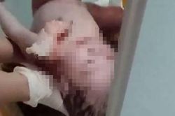 Sinh con rồi bỏ vào thùng rác, người mẹ 18 tuổi nói không biết mình mang thai
