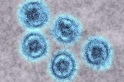 Những lo ngại trước chủng virus Ebola ở lợn có khả năng lây nhiễm sang con người