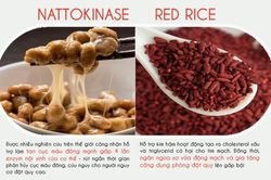 Cảnh giác đột quỵ sau cơn thiếu máu não thoáng qua khi trời trở lạnh