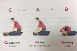 Sai lầm khi bỏ qua thời gian vàng chữa đột quỵ não