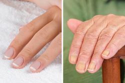 7 bộ phận cơ thể 'tố cáo' tuổi thật mà bạn không thể giấu