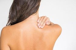 Cách trị thâm mụn ở lưng hiệu quả, đơn giản tại nhà
