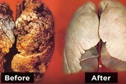 Ngăn ngừa ung thư phổi bằng tuyệt chiêu đặc biệt ít ai ngờ