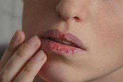 Thói quen làm đẹp gây hại sức khỏe quá nhiều chị em đang mắc
