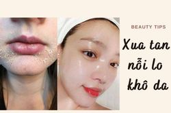 Da nứt nẻ ngày lạnh, cập nhật ngay 5 chiêu trị khô da trong 1 tuần