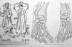 Sự thật về 'bàn chân Giao Chỉ' của người Việt cổ