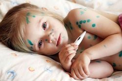 Thận trọng với tác dụng phụ của các thuốc điều trị thủy đậu