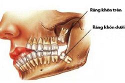 Khám phá những bí ẩn thú vị về cơ thể con người mà ít ai biết