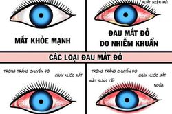 Những bệnh thường gặp về mắt