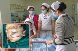 Cha ruột chém con trai 5 tuổi nguy kịch: Có biểu hiện thần kinh không bình thường sau khi vợ bỏ đi