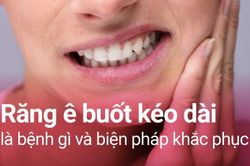 Tuyệt đối không được chủ quan khi răng ê buốt kéo dài
