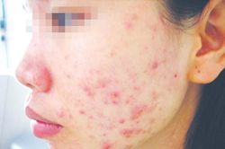 Sát Tết, lại khổ vì mỹ phẩm giả