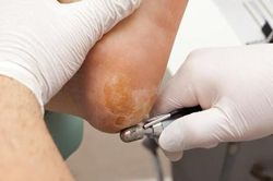 Gót chân thường xuyên bị khô và nứt nẻ, coi chừng sức khỏe đang 'kêu cứu'