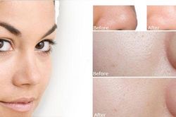 Lỗ chân lông se khít chỉ bằng cách sử dụng rau răm