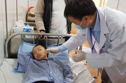 Hà Nội: Bé trai 8 tuổi bị chó béc giê cắn rách mặt và môi
