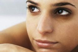 Ngủ nhiều mắt vẫn thâm chỉ vì lý do này