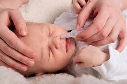 3 cách chữa nghẹt mũi cho trẻ mẹ phải biết