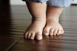 Trẻ đi khập khiễng, đau nhẹ khớp háng - Đừng bỏ qua