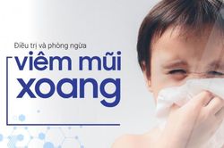 Viêm mũi, xoang gia tăng - Hệ lụy của khắc phục chưa đúng cách