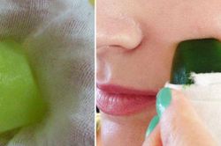 Mụn 'xẹp' nhanh chóng để đón Tết với cách vô cùng đơn giản