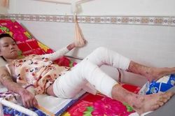 Xin cứu giúp nữ sinh nhà nghèo ở Sài Gòn bị phỏng nặng!