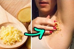 6 cách trị 'viêm cánh' tại nhà ai cũng làm được