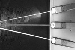 Những ưu thế của siêu âm bằng laser