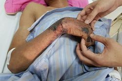 Mổ lợn đánh tiết canh đón Tết - Coi chừng mắc bệnh chết người