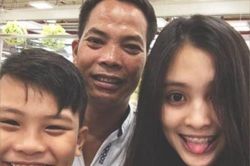 Hoa hậu Tiểu Vy trước và sau khi niềng răng