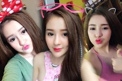 Ngân 98 hiếm hoi chia sẻ loạt ảnh thời tiêm đầy filler trên gương mặt