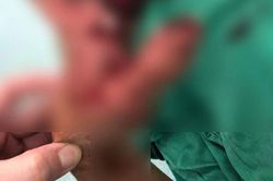 Nhiều ca thương tích nặng do pháo nổ tại các tỉnh phía Nam