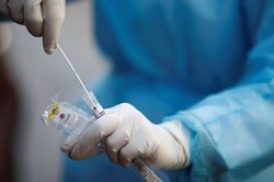 Nga đăng ký bộ xét nghiệm phát hiện biến thể mới của SARS-CoV-2