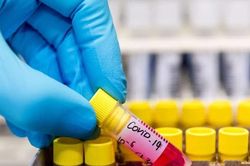Việt Nam ghi nhận 4 biến chủng của virus SARS-CoV-2