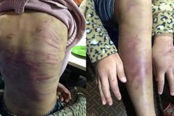 Hà Nội: Xử nghiêm vụ bé gái bị bạo hành, xâm hại tình dục