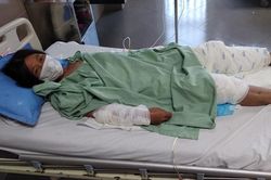 Vợ bỏng nặng toàn thân vì chồng đổ xăng đốt