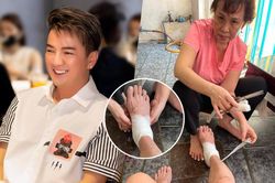 Đàm Vĩnh Hưng gặp tai nạn bị thương ở chân phải băng bó, tiết lộ nhận được 'điềm báo' từ trước