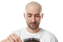 Phương pháp tái tạo tóc cho người hói