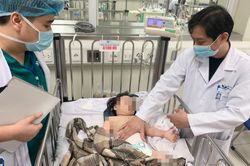 Bé gái trật khớp háng khi rơi từ tầng 12A