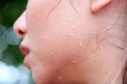 Đổ mồ hôi là điều bình thường, nhưng nếu xuất hiện ở những nơi này, chứng tỏ sức khỏe có vấn đề, 1 vị trí là dấu hiệu của đột quỵ