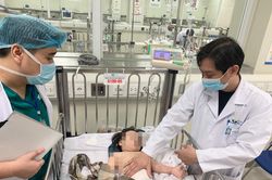 Kết quả chụp CT sọ não bé gái 2 tuổi rơi từ tầng 13