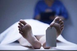 Những biến đổi 'kinh dị' của cơ thể chúng ta sau khi chết