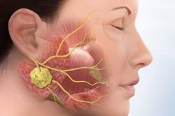 Khuyến cáo: bệnh quai bị đang vào mùa