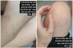 Trai lạ thả tim, cô gái bị người yêu đánh gây bức xúc