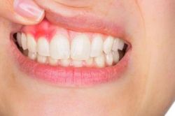 5 hiện tượng cho thấy bạn đang già đi, phương pháp giúp làm chậm quá trình lão hóa