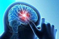 Nghỉ dịch ăn món này nhiều, bệnh nhân chết thảm vì xuất huyết não