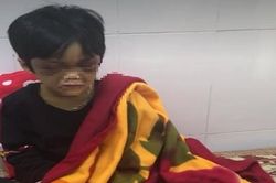 Cháu bé 6 tuổi nghi bị bạo hành, bỏ đói