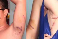 Hai mẹ con bị chém gục khi nhắc nhở hàng xóm xây lấn vỉa hè